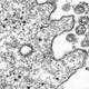 Viral particles of SARS-CoV-2, seen under a transmission electron microscope in a sample taken from a person.